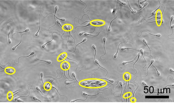 sperm cells under microscope