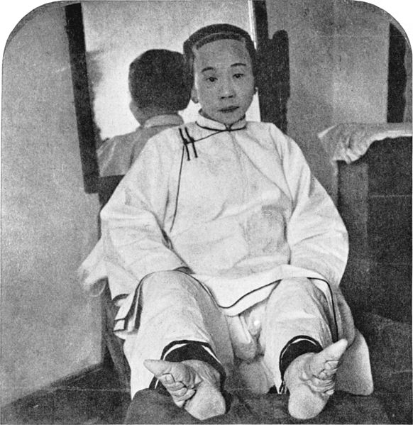 black and white photograph of a woman with bound feet