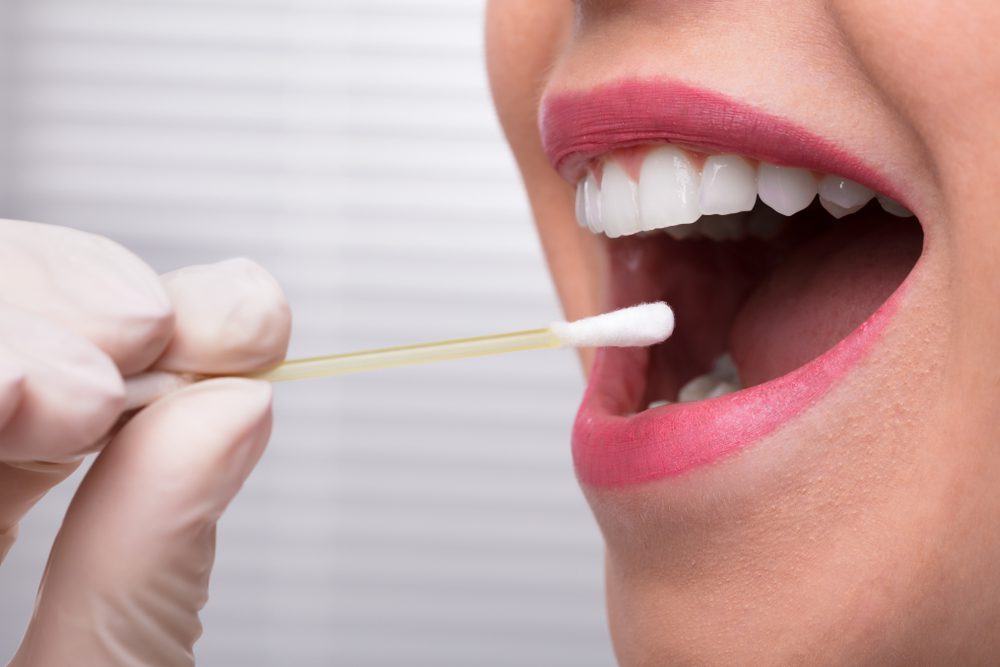 mouth swab DNA test