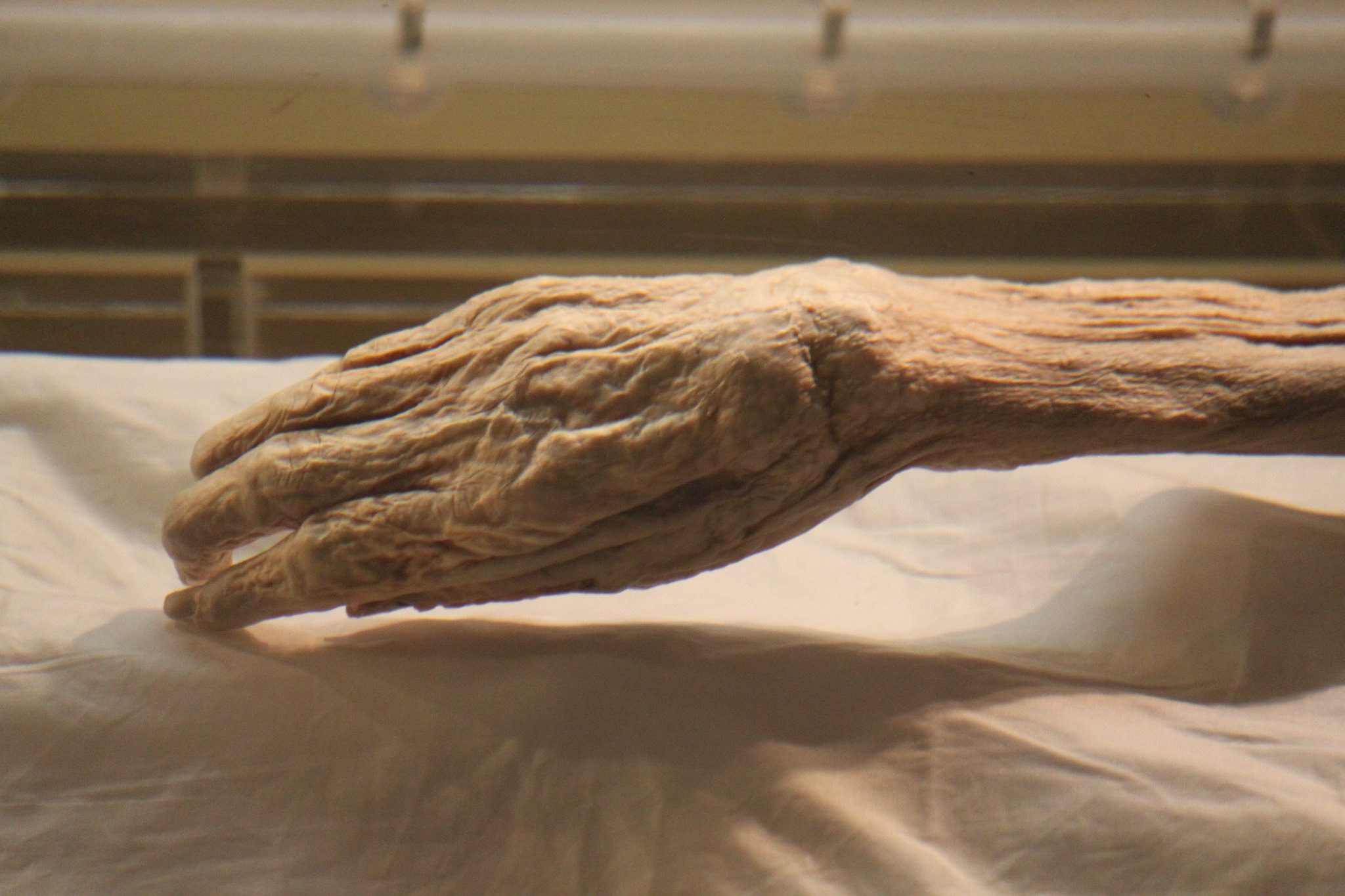 The mummified hand of Lady Dai, the best preserved mummy in the world.