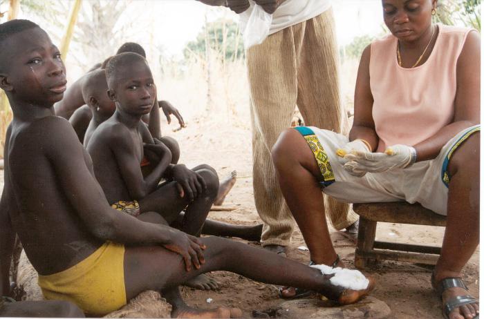 A crying girl named Akouma from the Dofelgou District of Northern Togo getting a Guinea worm removed. 