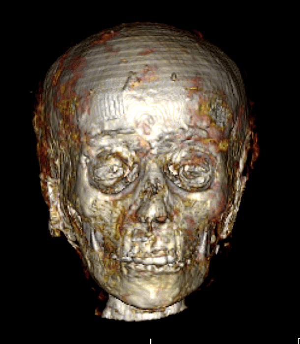CT scan of face of ancient Egyptian mummy Golden Boy.