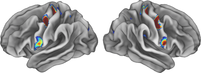 SCAN displayed on brain images