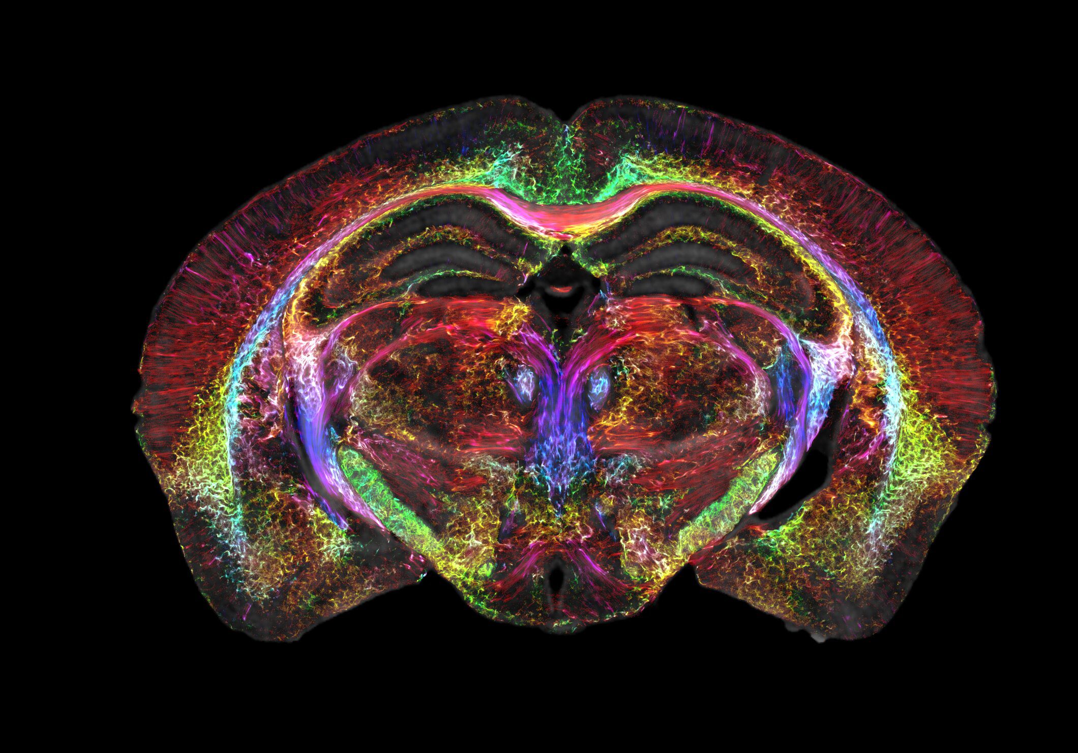 coronal section of mouse brain