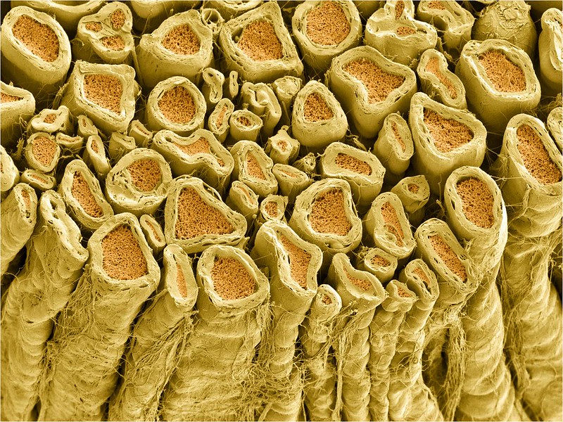 microscopy image of myelinated axons