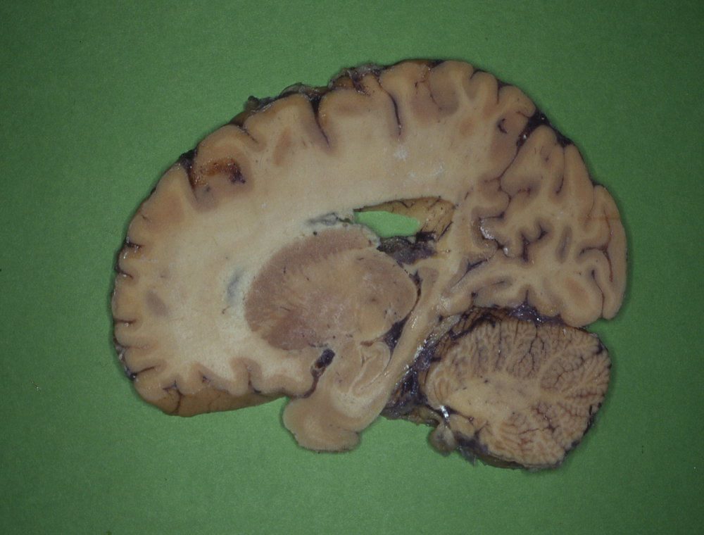 human brain slice