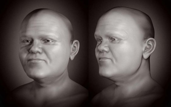 Dwarf reconstruction without hair