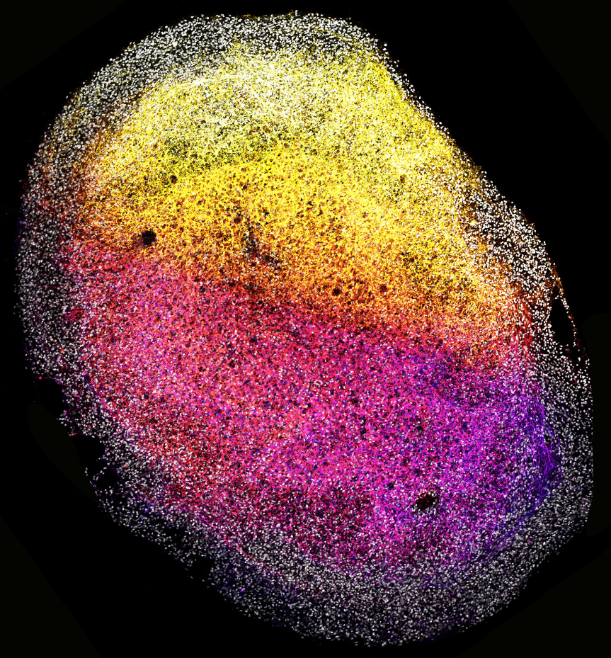 An image of a whole human fetal brain organoid. Stem cells are marked by SOX2 (grey) and neuronal cells (TUJ1) are color coded from pink to yellow based on depth.