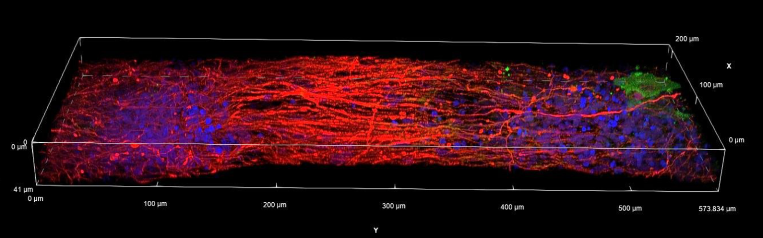 3D printed human cortical-striatal tissue showed unidirectional projection. Red staining with SMI321, indicating the cortical axon projection; Green staining with ChrR2-EYFP, indicating striatal cells; Blue is cell nucleus staining