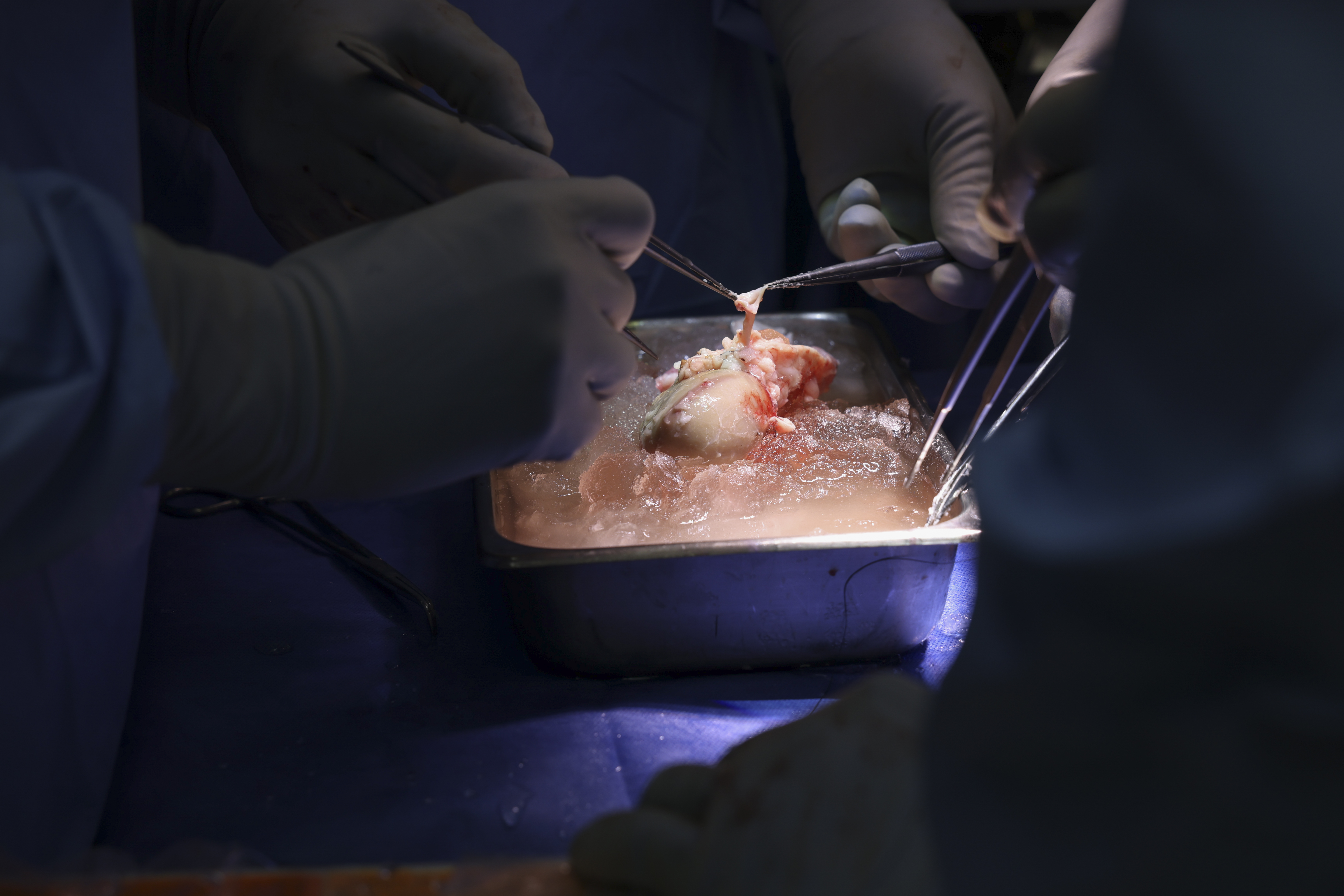 pig kidney on ice; surgeons' hands using tools are visible, as they prepare the kidney for transplantation