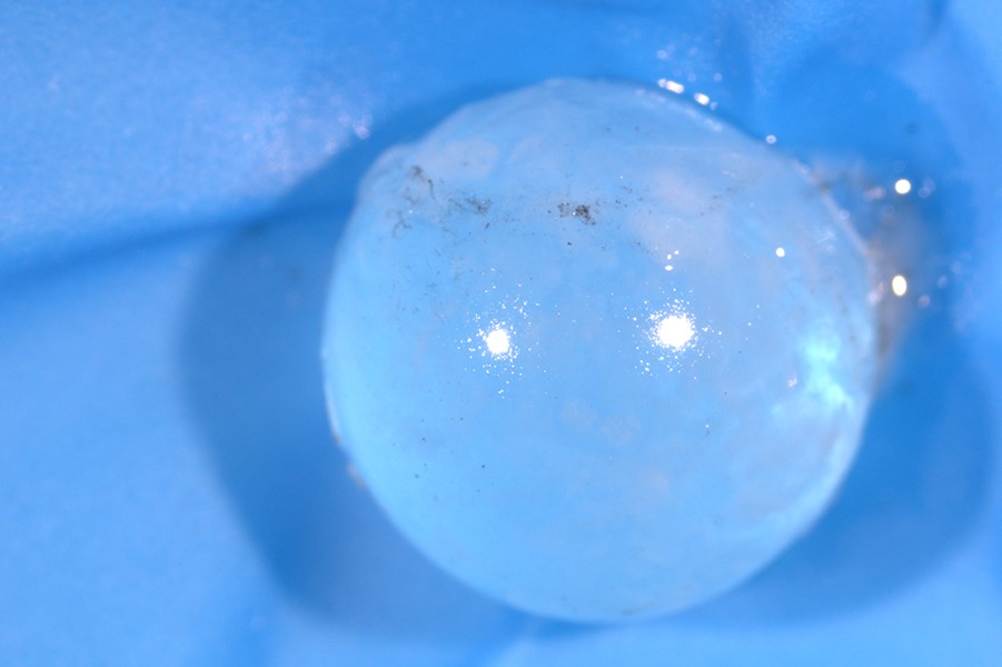 Close up of a shark eye lens white, but slightly see-through) on a blue background.