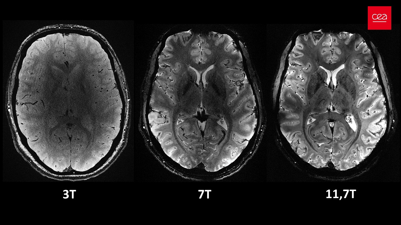 scans of the brain using 3T, 7T and 11.7T MRI machines side by side