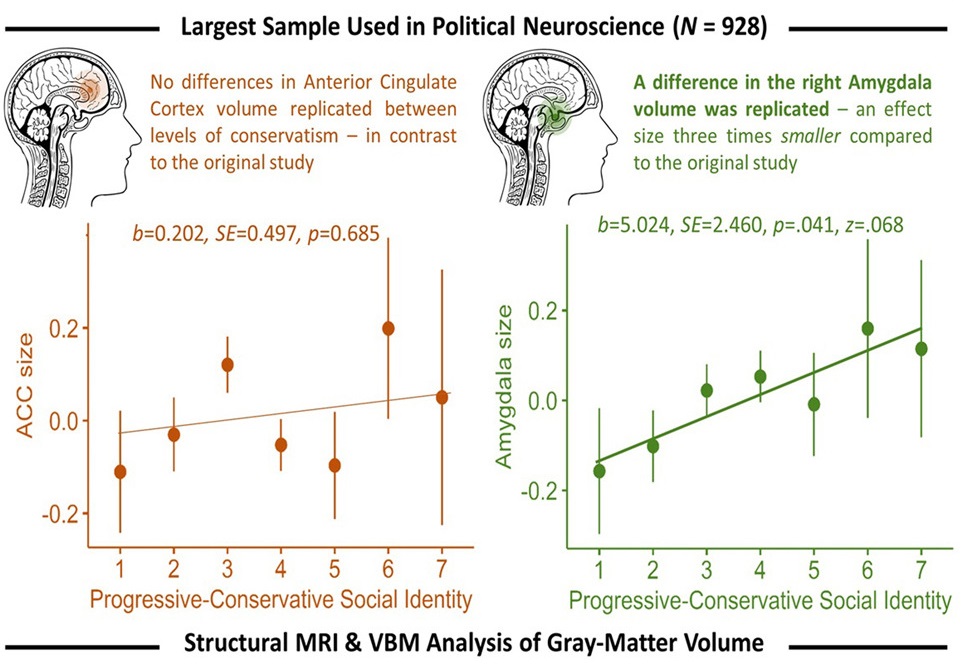 graphical abstract of the study with graphs and diagrams to explain the key findings relating to the anterior cingulate cortex and amygdala