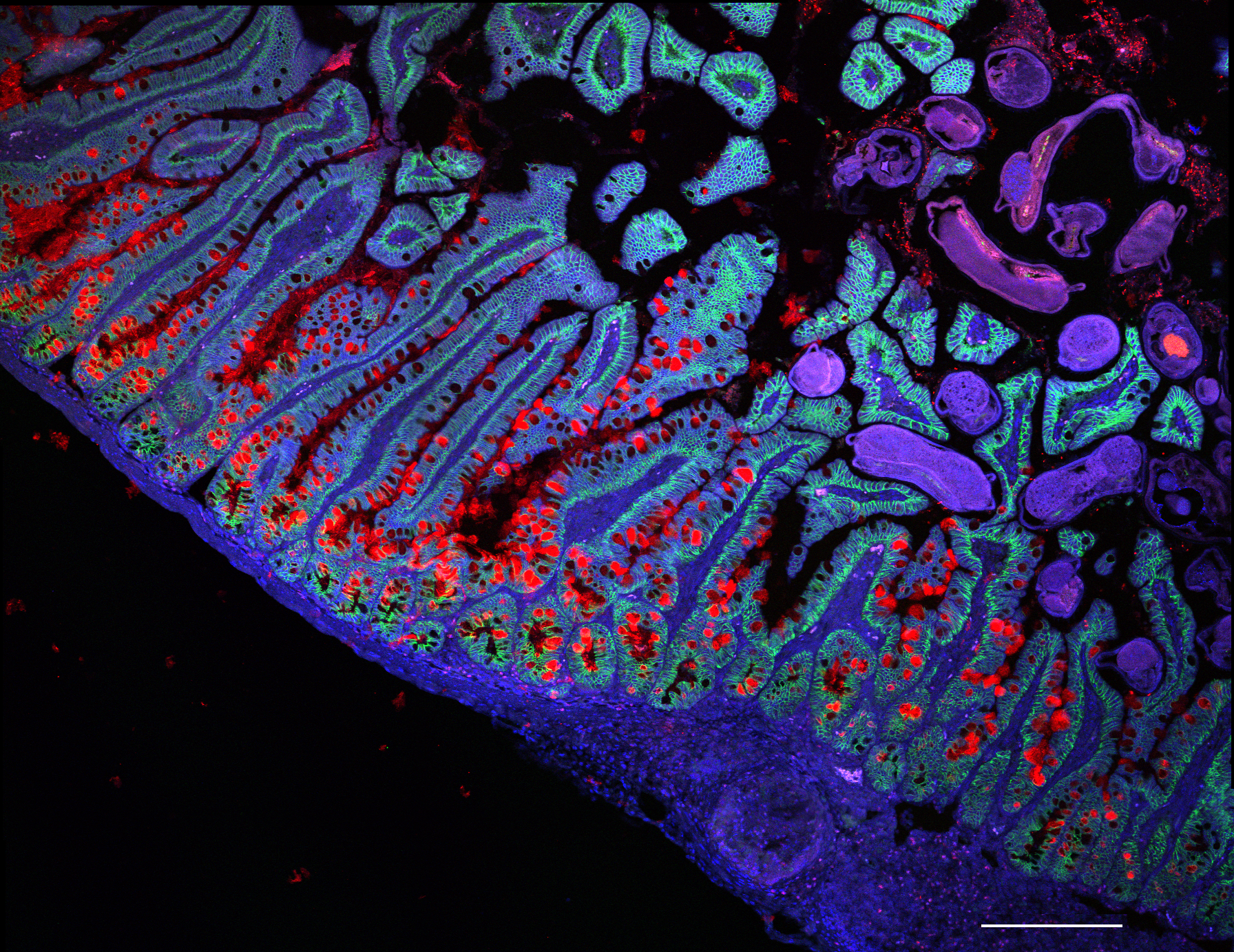 microscope image of piece of human small intestine, colorized in shades of blue, purple, red, and green