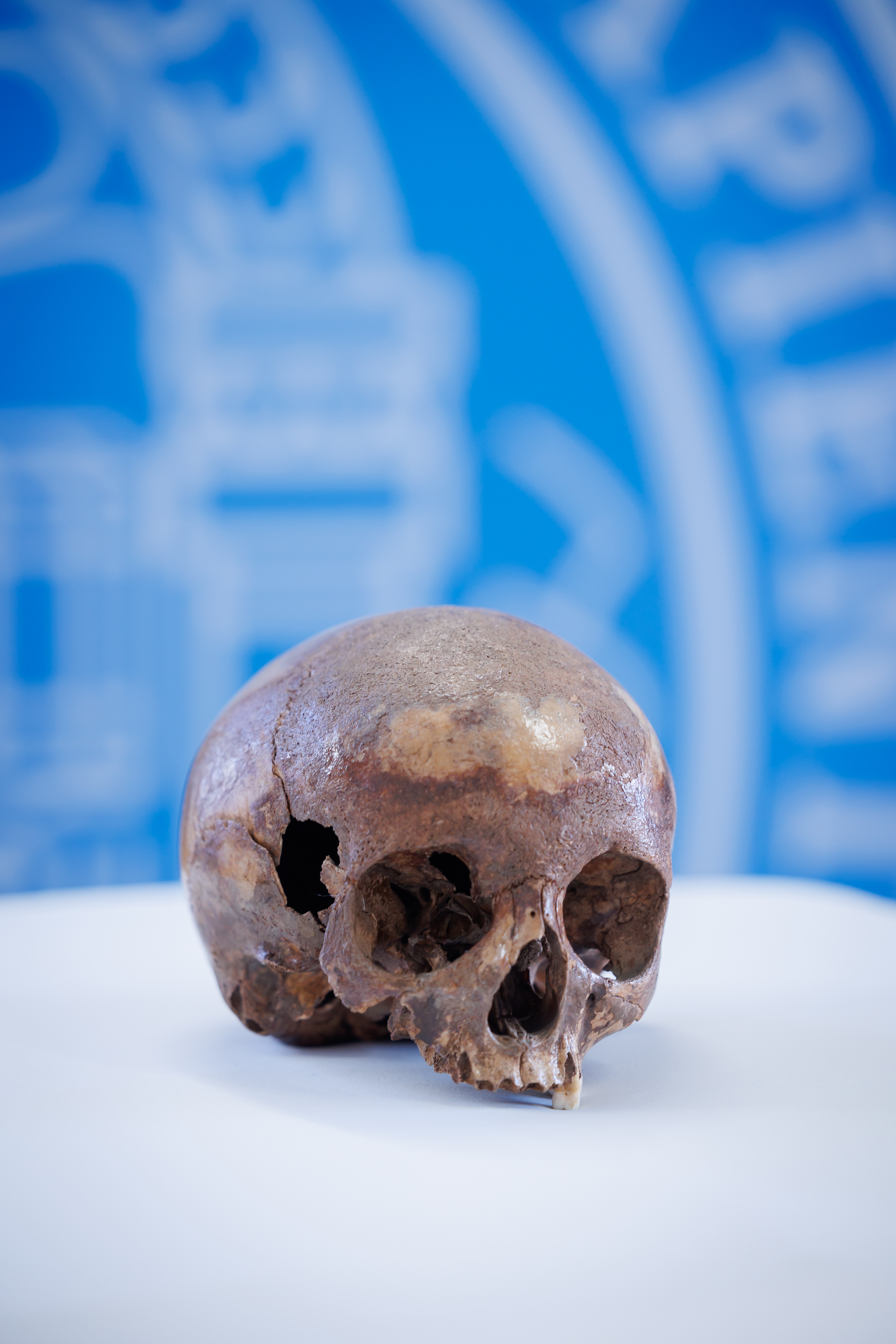 A close up photo of the skull resting on a white table stand at the press conference. The skull is a deep brown colour and missing its lower jaw. There is also a large fractured hole in the left had side. 