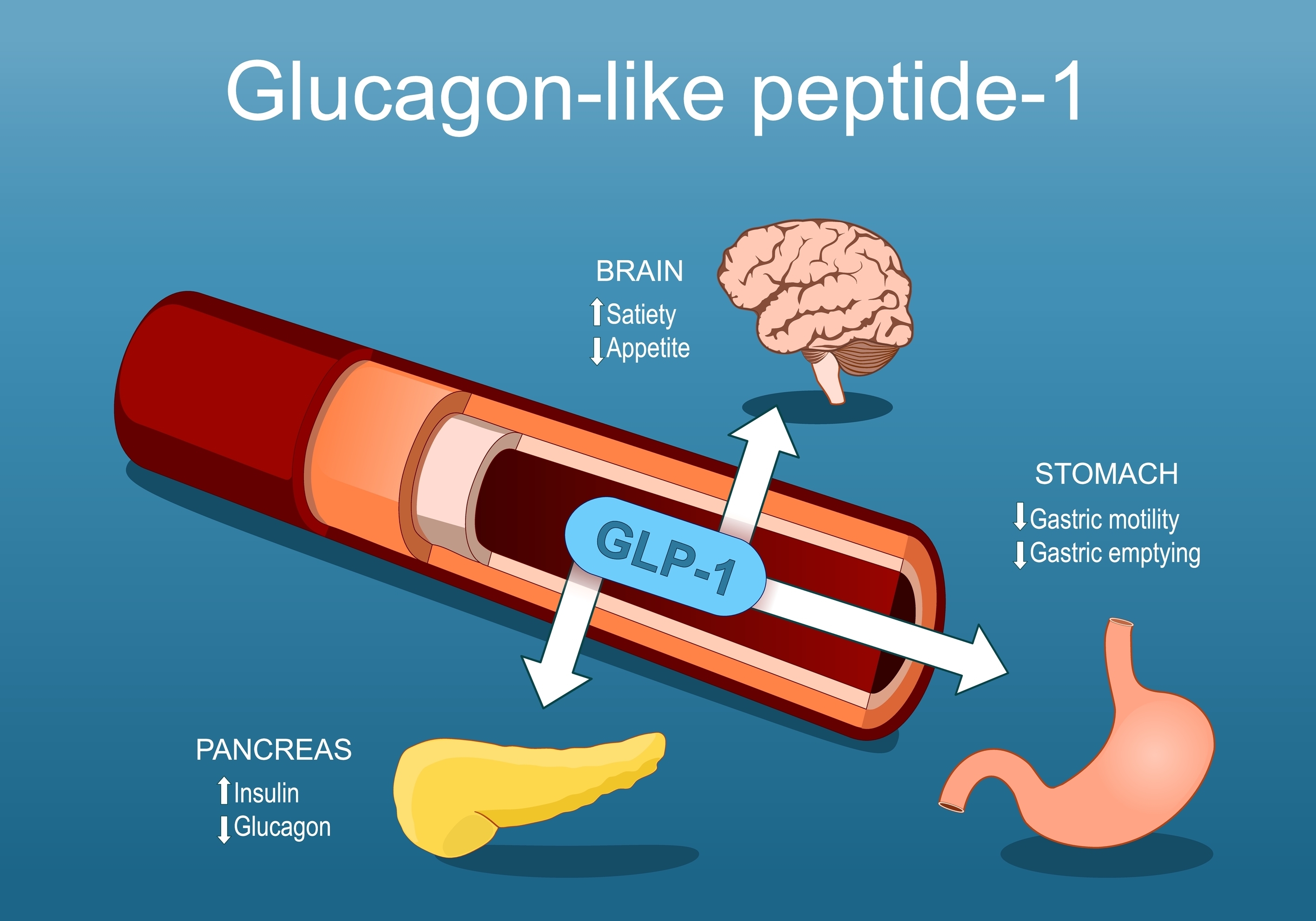 diagram showing a drawing of a pen used to inject GLP-1 receptor agonist drugs. There are arrows pointing to a brain, a stomach and a pancreas. Each of these has an up and or down arrow to show the effects of the drug, which are: increased satiety and decreased appetite (brain), decreased gastric motility and emptying (stomach), and increased insulin and decreased glucagon (pancreas)