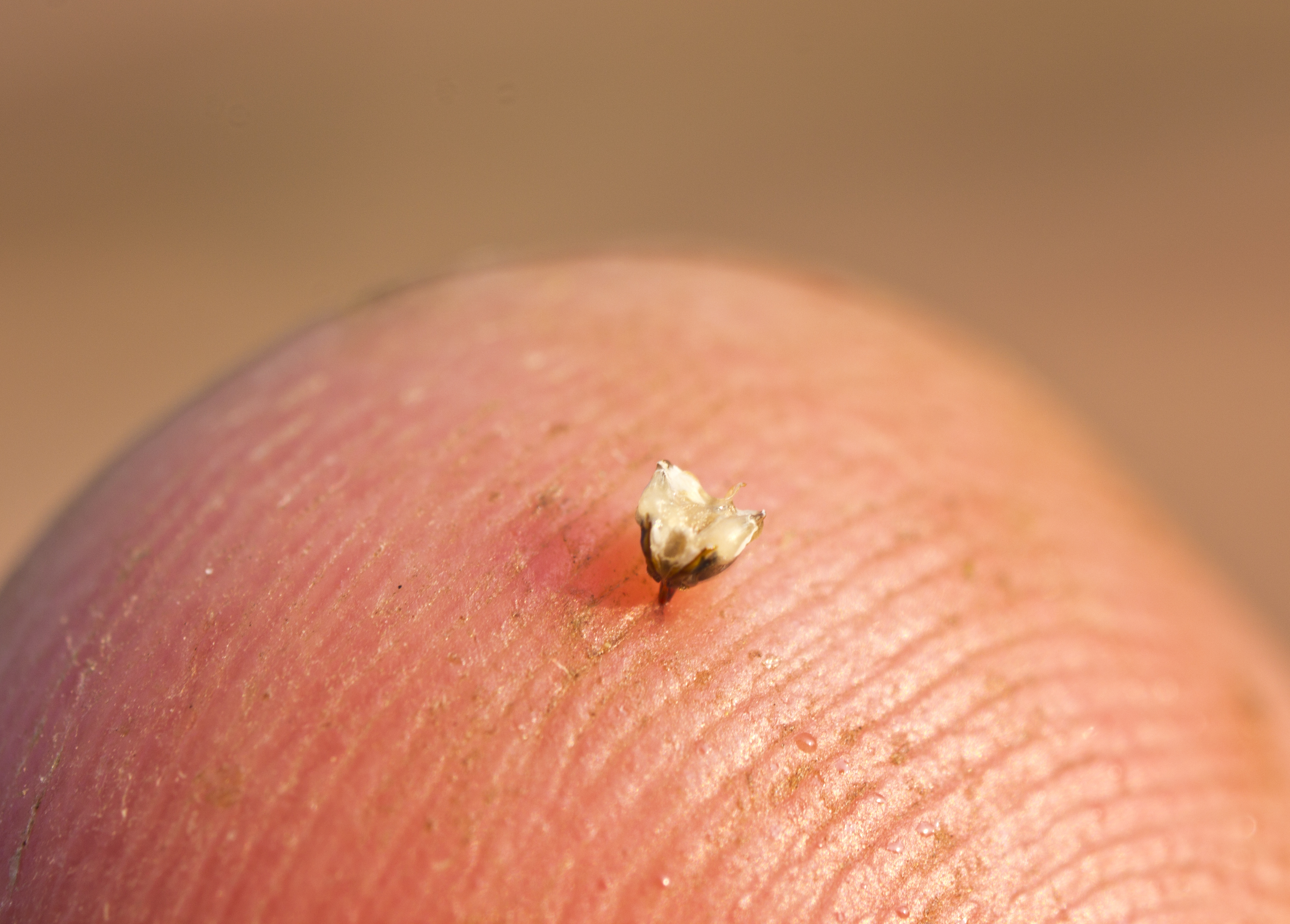 Bee stinger in human skin