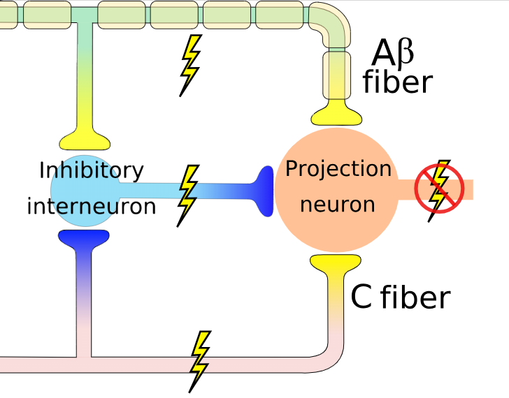 Depiction of neuronal firing in the gate control theory of pain, with firing of A beta fibers