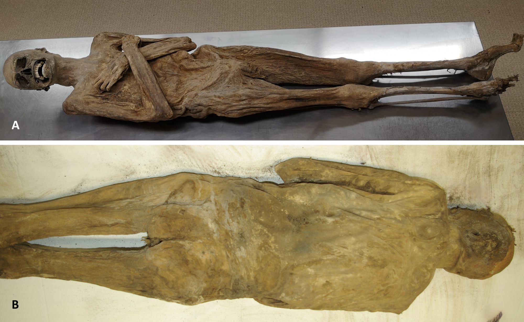 External appearance of the mummy from the ventral (A) and dorsal side (B) showing a completely intact body wall. Credit: Andreas Nerlich. External appearance of the mummy from the ventral (A) and dorsal side (B) showing a completely intact body wall. Credit: Andreas Nerlich.