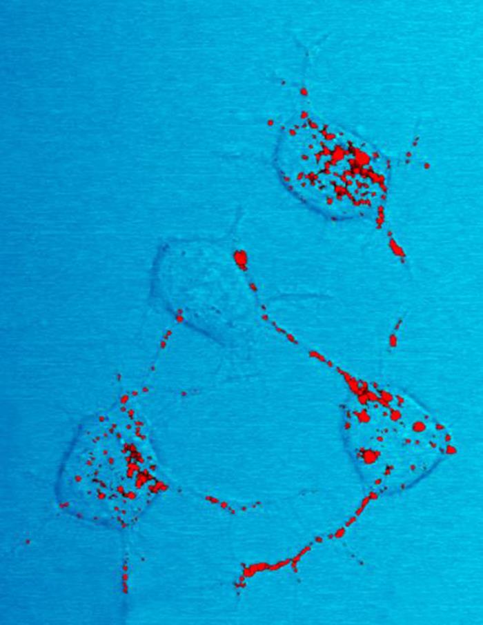 This photomicrograph shows fluorescently labeled prions (red) that have been taken up and distributed in rodent brain cells. This photomicrograph shows fluorescently labeled prions (red) that have been taken up and distributed in rodent brain cells.