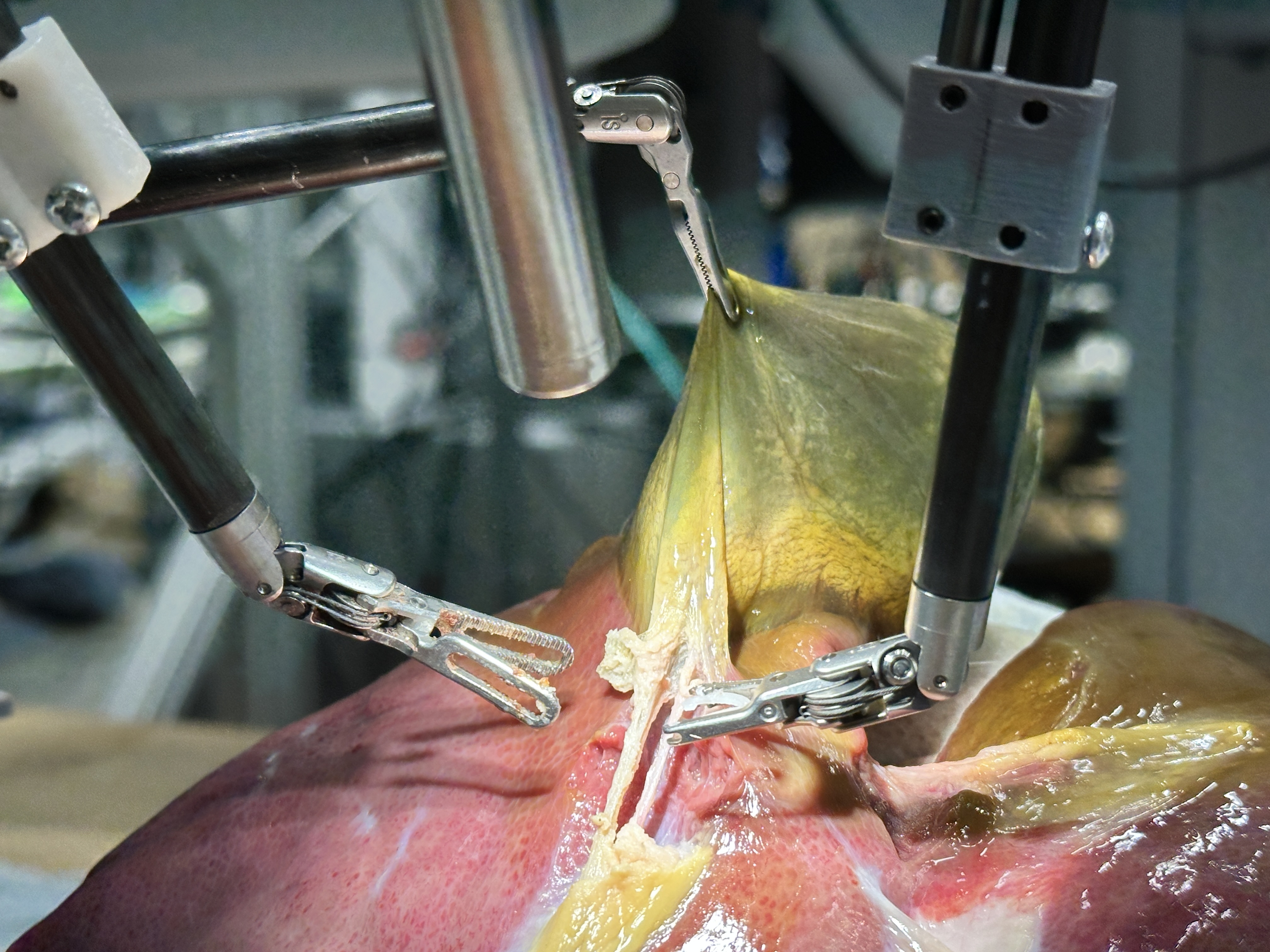close up of surgical robot arms manipulating tissues during gallbladder removal ex vivo in a pig close up of surgical robot arms manipulating tissues during gallbladder removal ex vivo in a pig