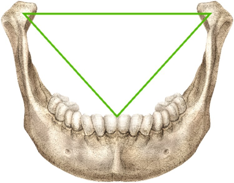 Boswell's triangle: a green equilateral triangle inscribed within the lower jaw of a human.