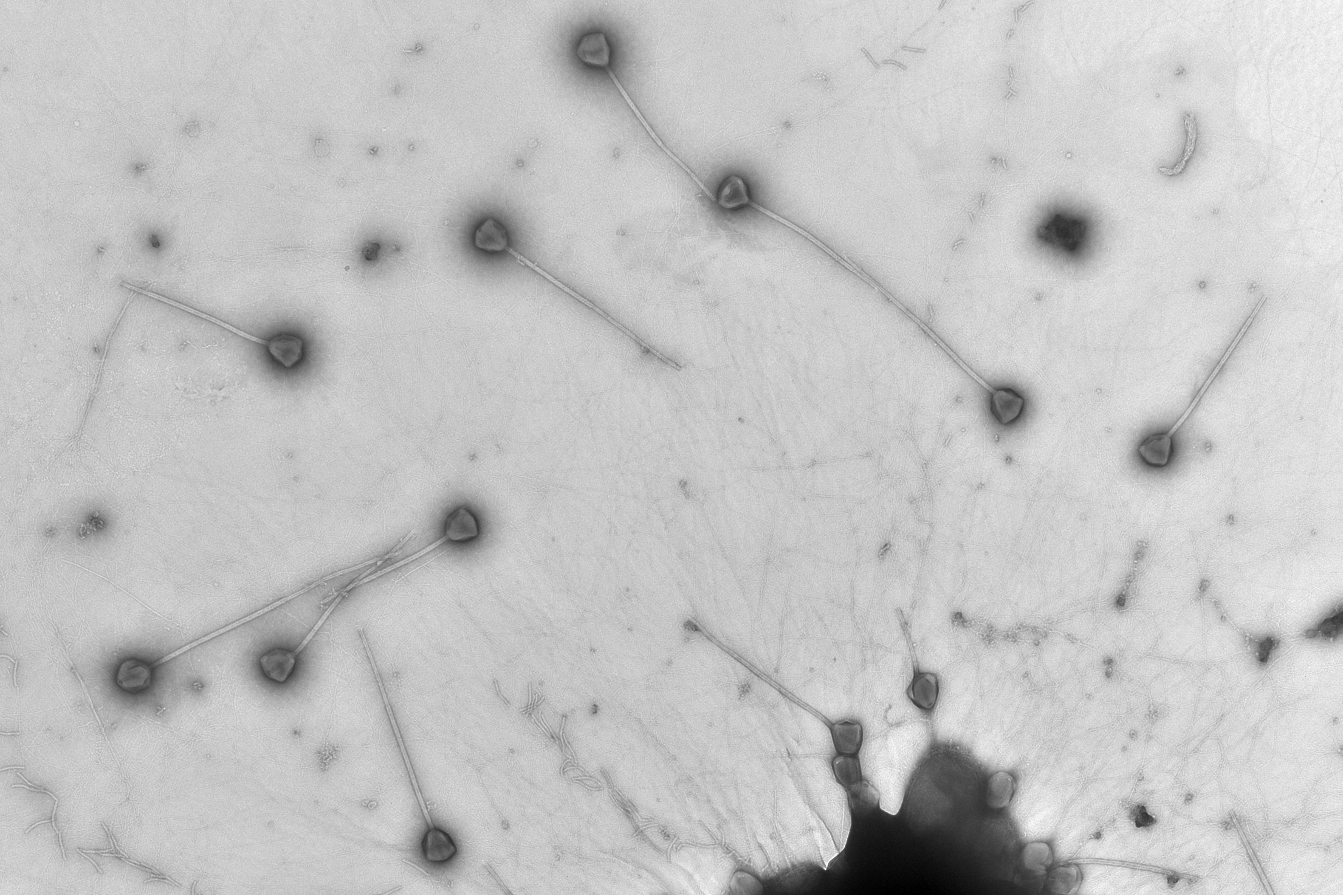micrograph with lots of viruses with long straight tails micrograph with lots of viruses with long straight tails