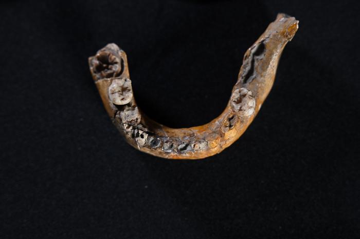 A photo showing the child's fossilized jaw set against a black background. The jaw is small and deeply tanned. There are only six teeth still present in it, five of which were located on the left of the image and one is on its own on the right. 