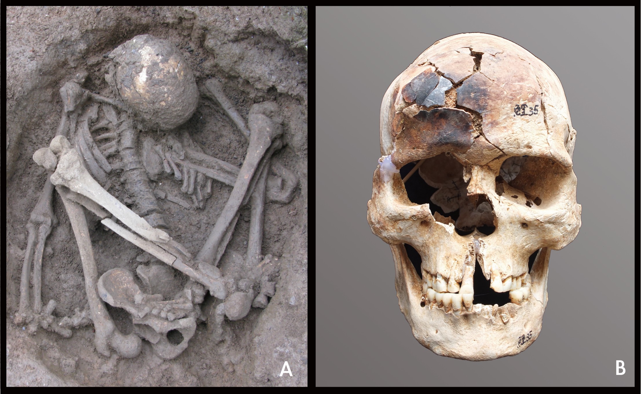 Prehistoric mummy and skull
