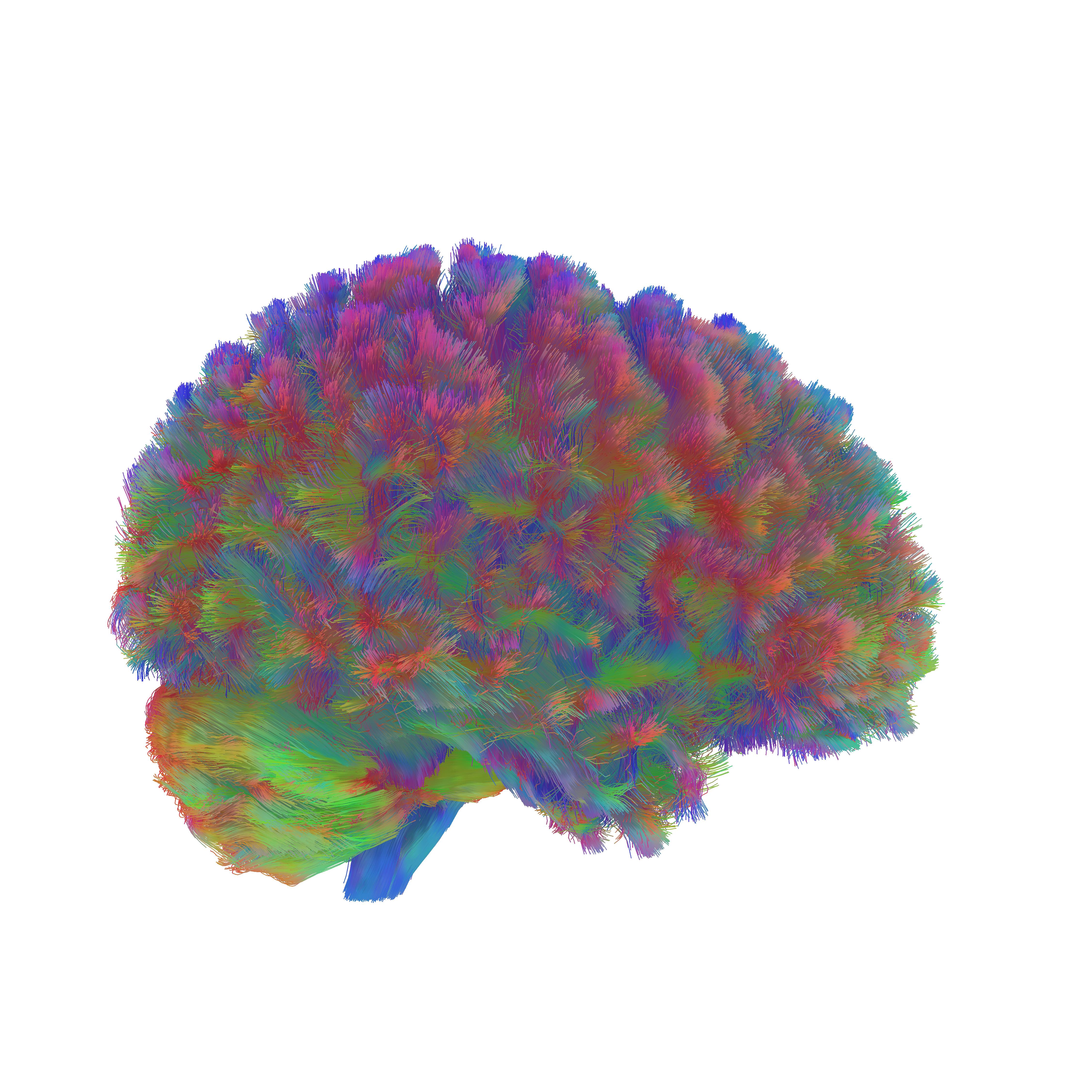 A representative MRI tractography image of the third era of the human brain. This image is representative of the general pattern seen across the brains in the study during the third era of neural wiring, which begins in the early thirties and lasts over three decades.  