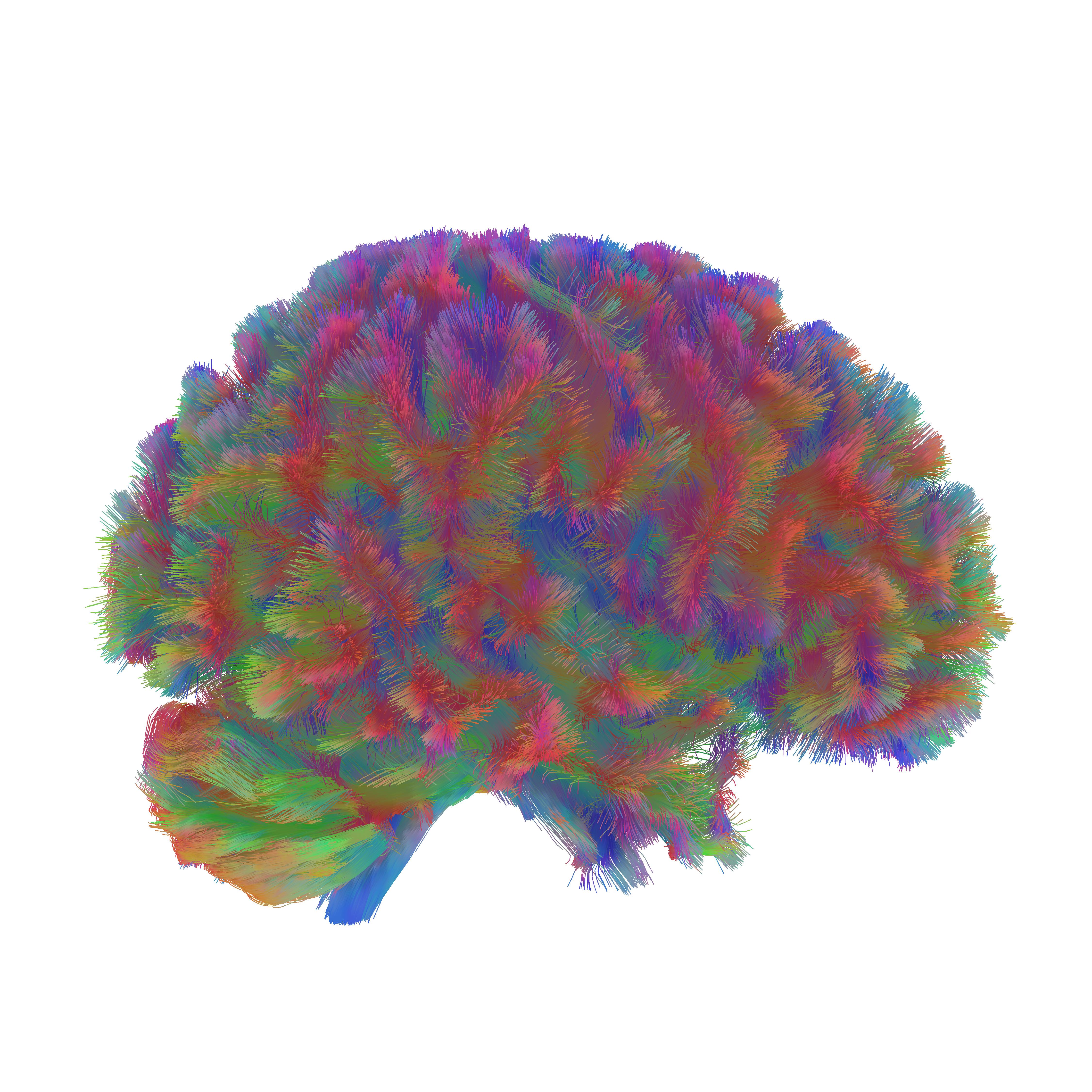 A representative MRI tractography image of the fifth era of the human brain. This image is representative of the general pattern seen across the brains in the study during the fifth era of neural wiring, the the “late aging” phase. 